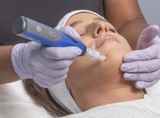 SKN: hydroquinone treatment (stubborn sun spots/melasma)